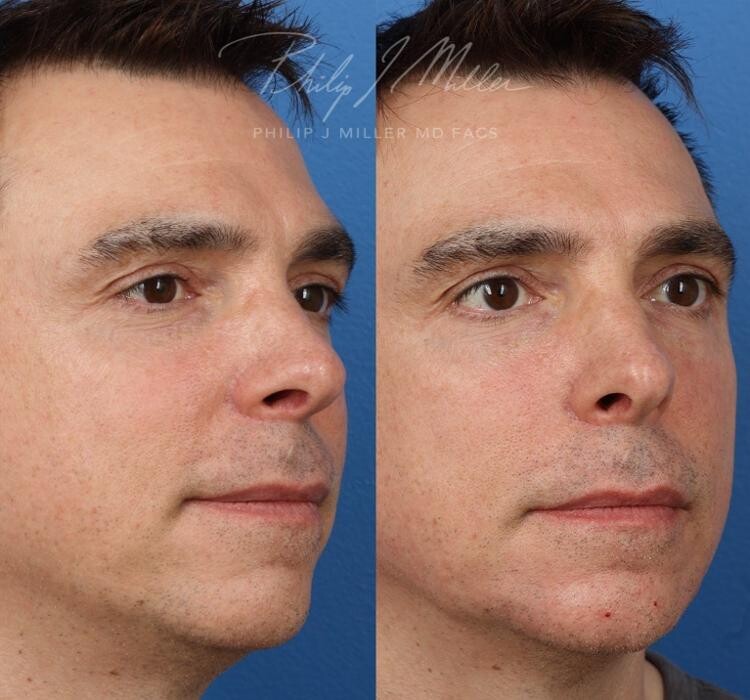 Images Gotham Plastic Surgery