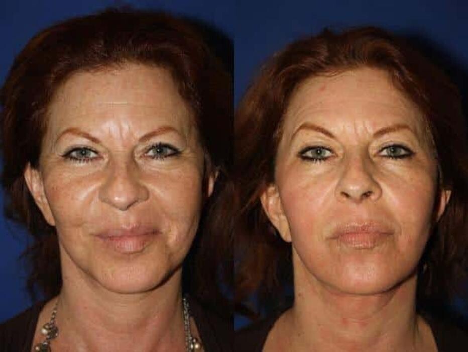 Images Gotham Plastic Surgery
