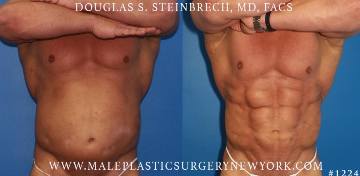 Images Gotham Plastic Surgery