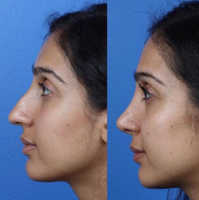 Images Gotham Plastic Surgery