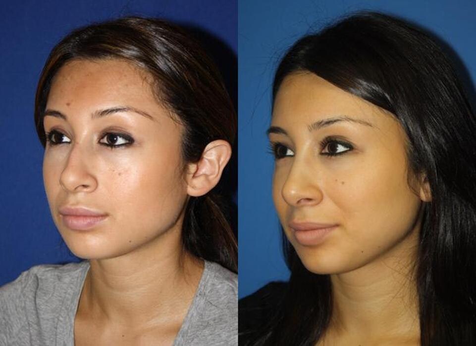 Images Gotham Plastic Surgery