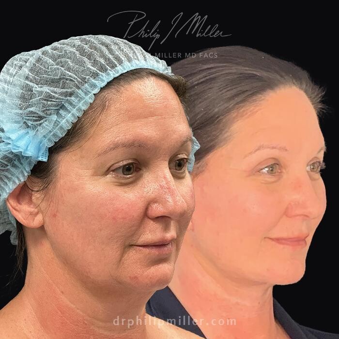 Images Gotham Plastic Surgery