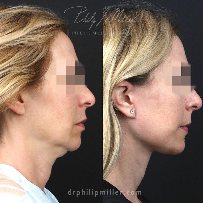 Images Gotham Plastic Surgery