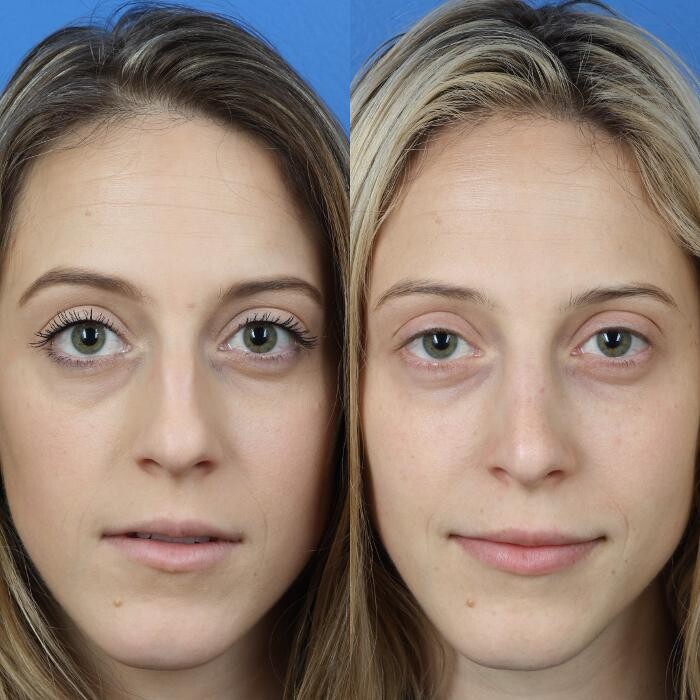 Images Gotham Plastic Surgery