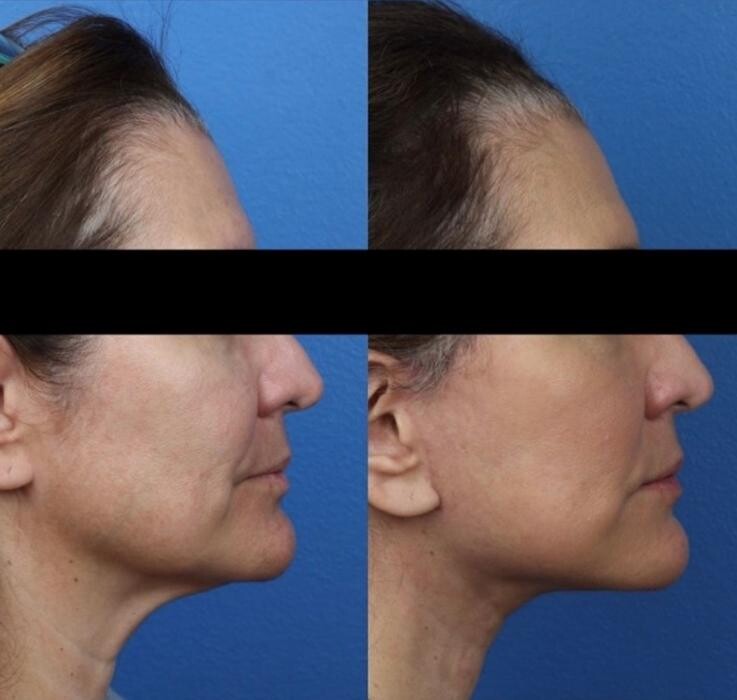 Images Gotham Plastic Surgery