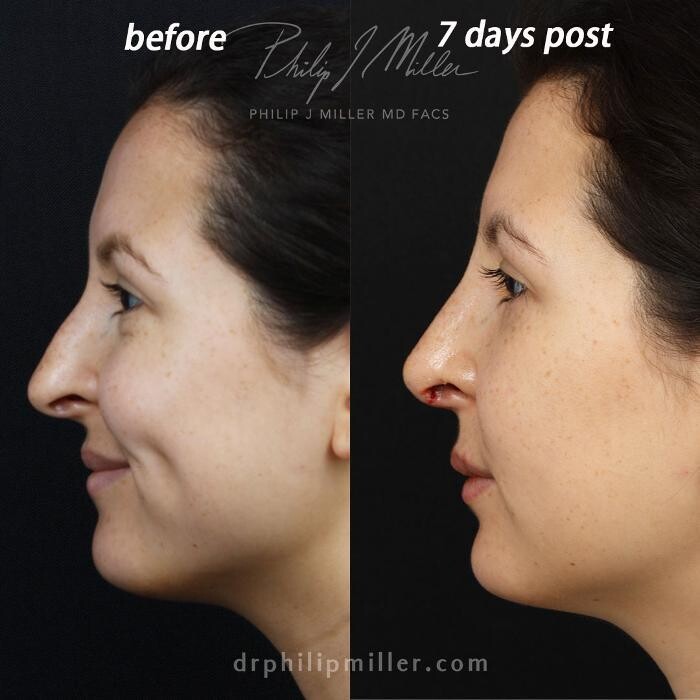 Images Gotham Plastic Surgery