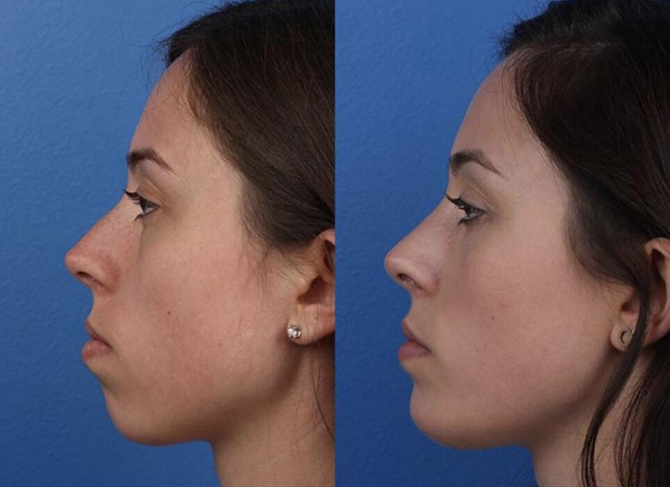 Images Gotham Plastic Surgery