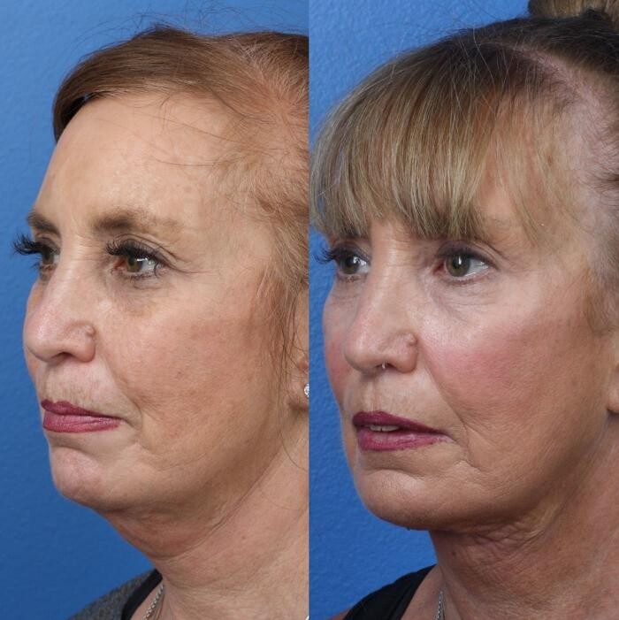 Images Gotham Plastic Surgery