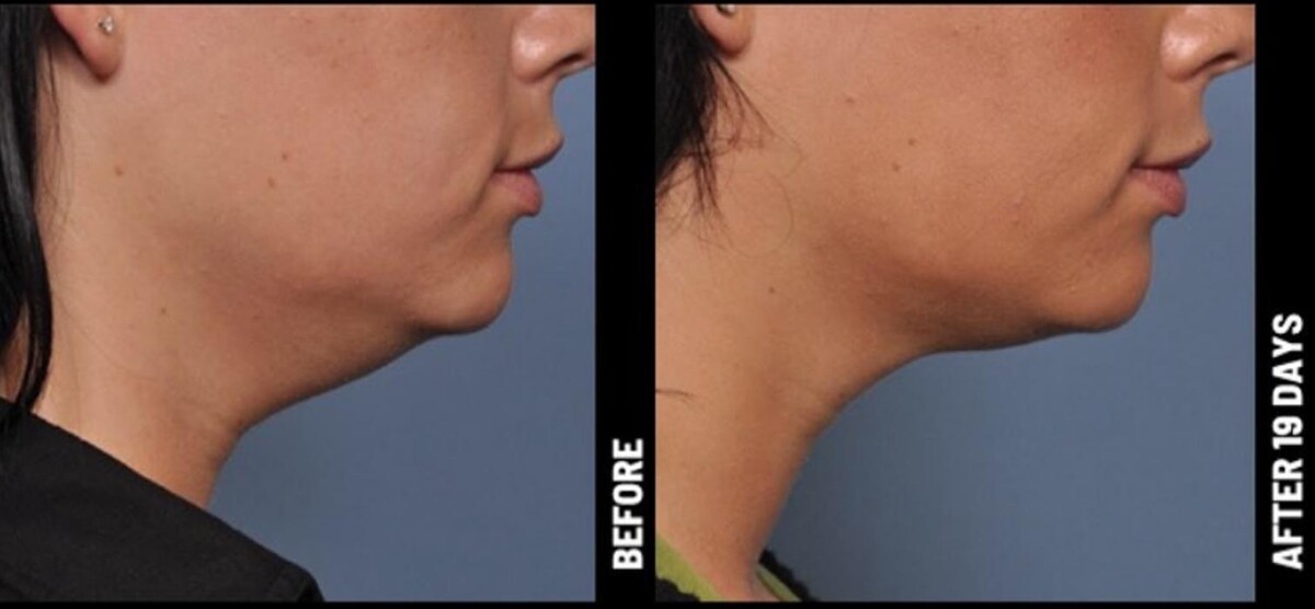 Images Gotham Plastic Surgery