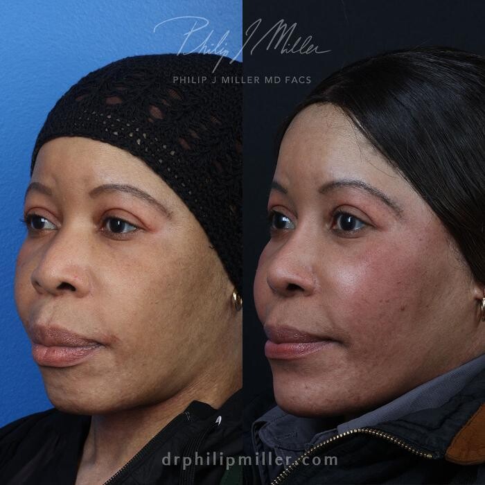 Images Gotham Plastic Surgery