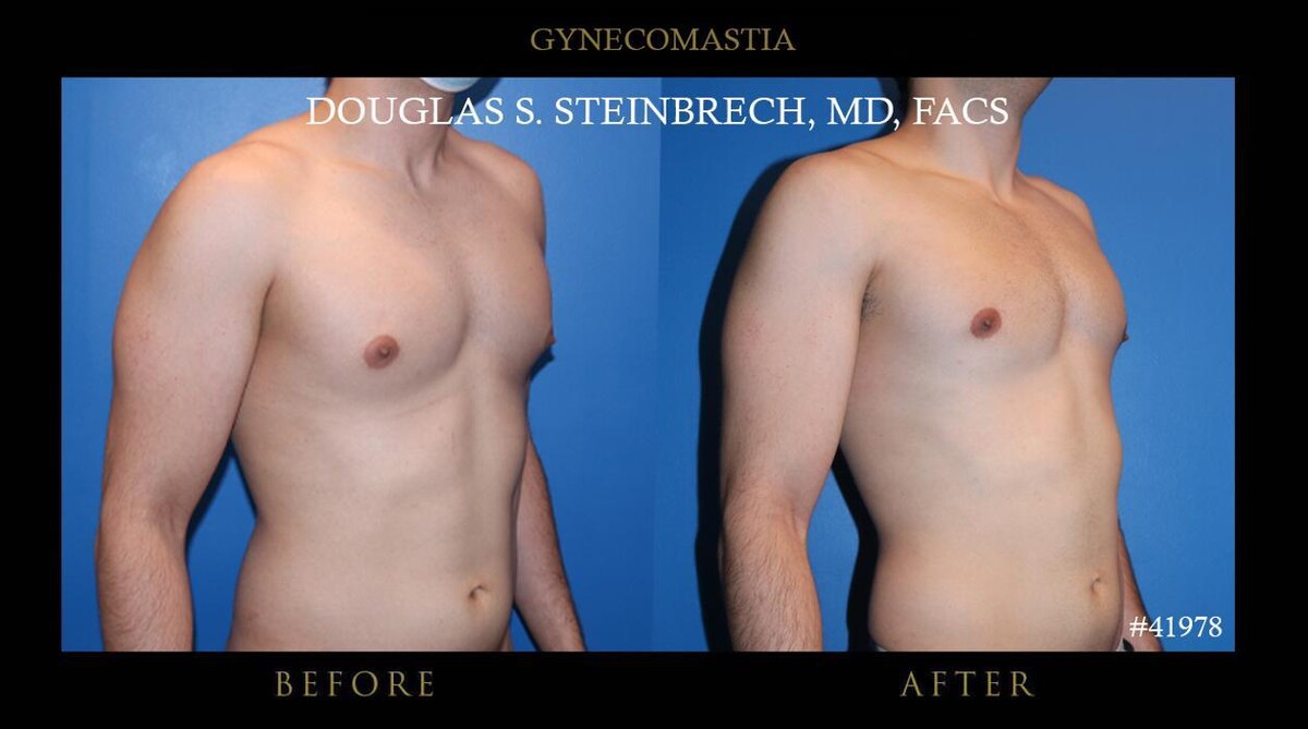 Images Gotham Plastic Surgery