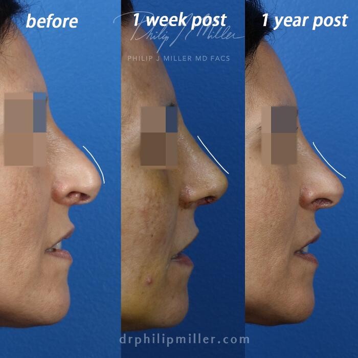 Images Gotham Plastic Surgery