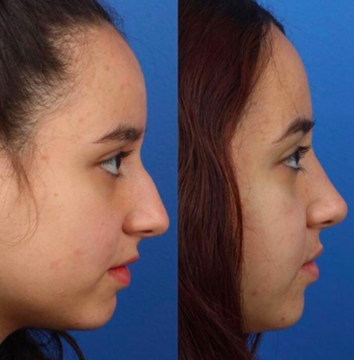 Images Gotham Plastic Surgery