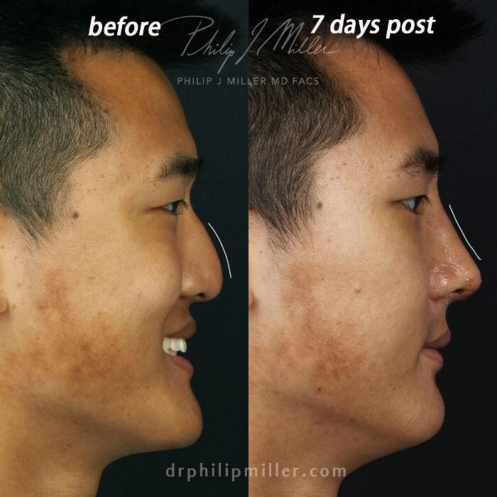 Images Gotham Plastic Surgery