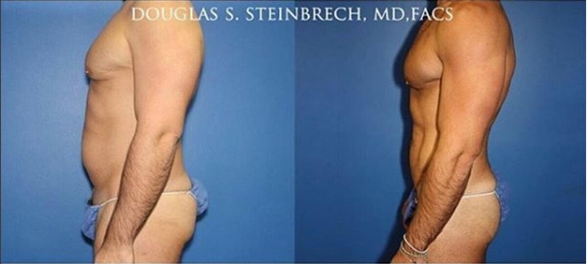 Images Gotham Plastic Surgery