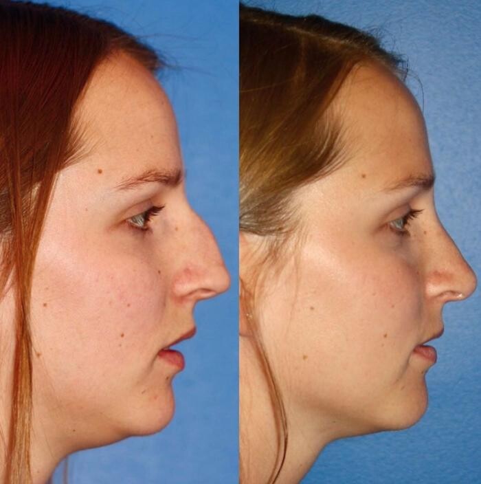 Images Gotham Plastic Surgery