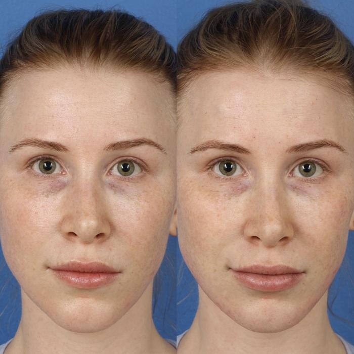 Images Gotham Plastic Surgery