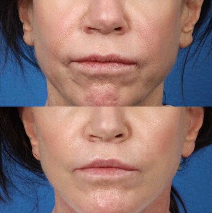 Images Gotham Plastic Surgery