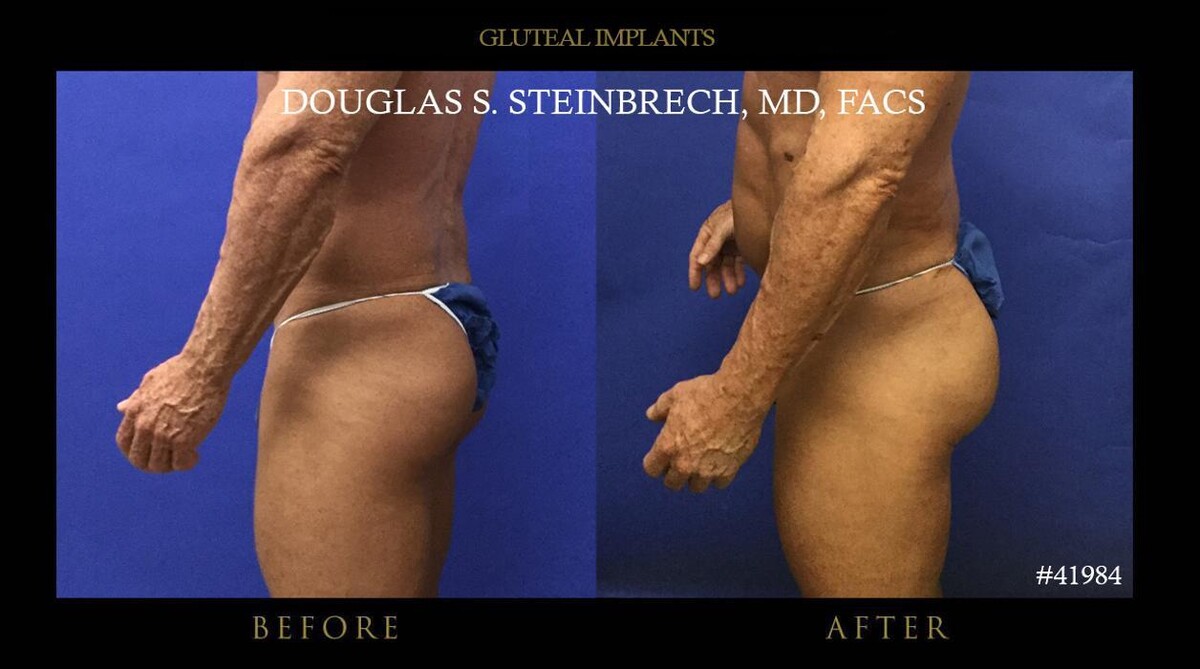 Images Gotham Plastic Surgery