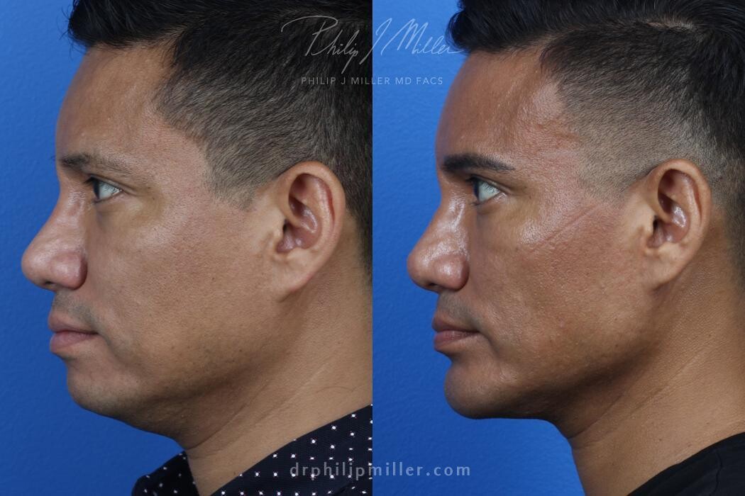 Images Gotham Plastic Surgery