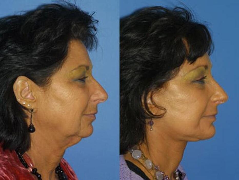 Images Gotham Plastic Surgery