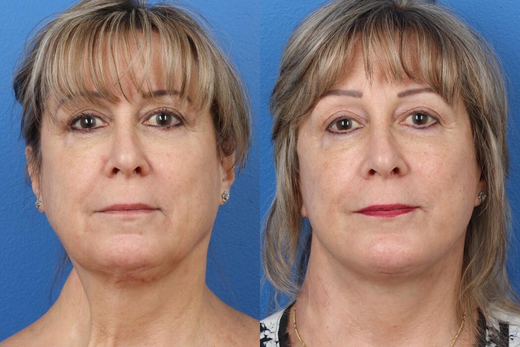 Images Gotham Plastic Surgery