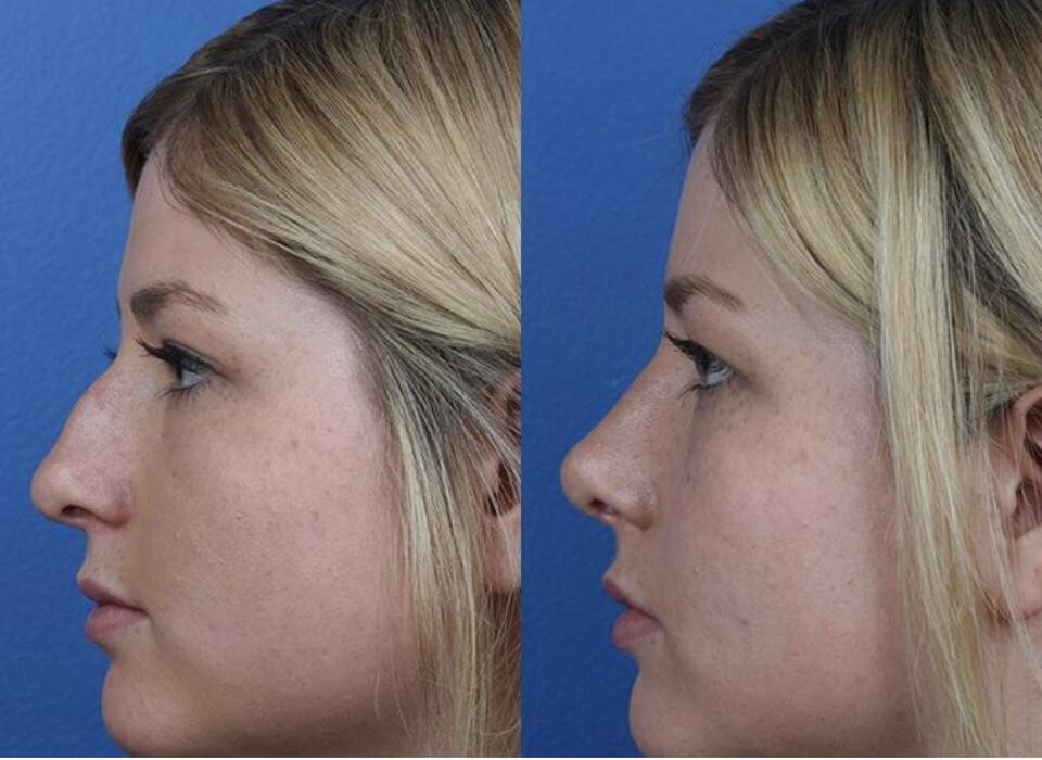 Images Gotham Plastic Surgery