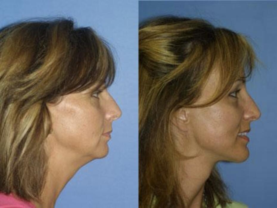 Images Gotham Plastic Surgery