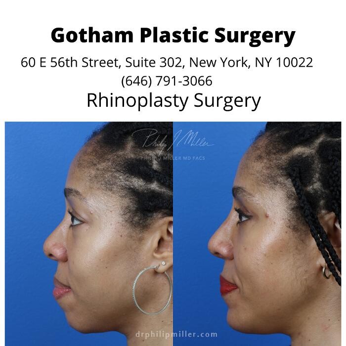 Images Gotham Plastic Surgery