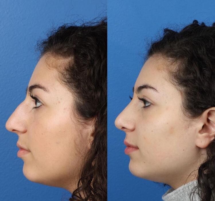 Images Gotham Plastic Surgery