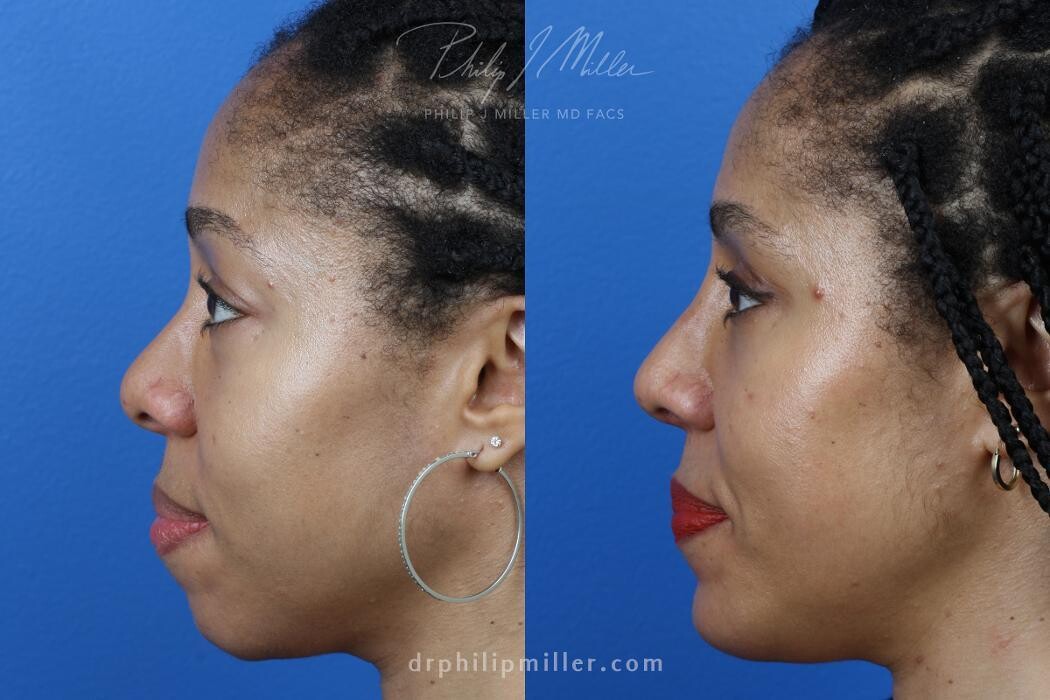 Images Gotham Plastic Surgery