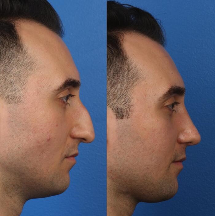 Images Gotham Plastic Surgery