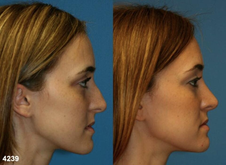 Images Gotham Plastic Surgery