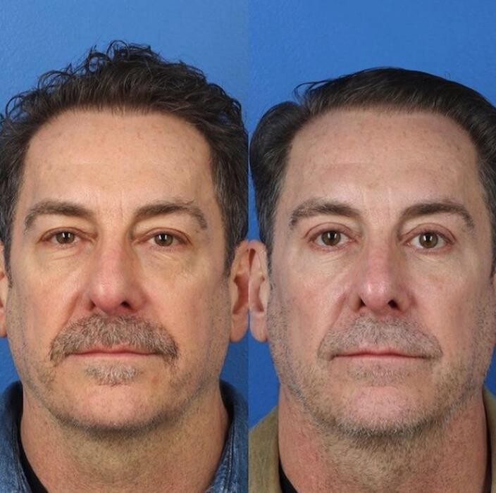 Images Gotham Plastic Surgery