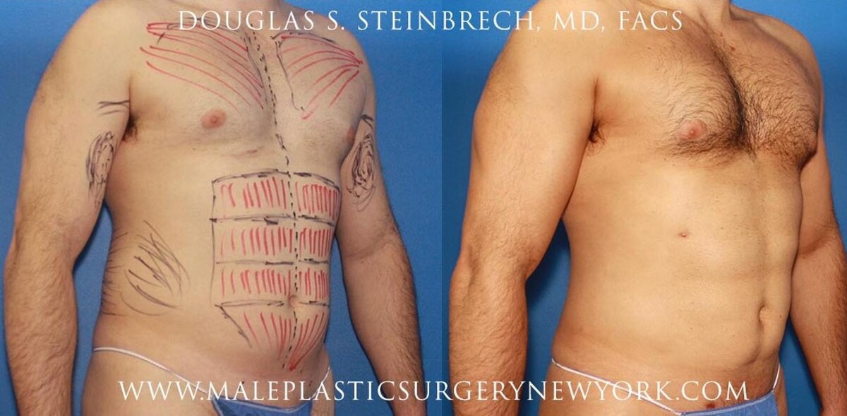Images Gotham Plastic Surgery