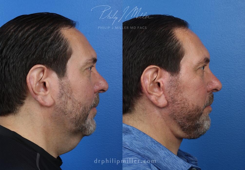 Images Gotham Plastic Surgery