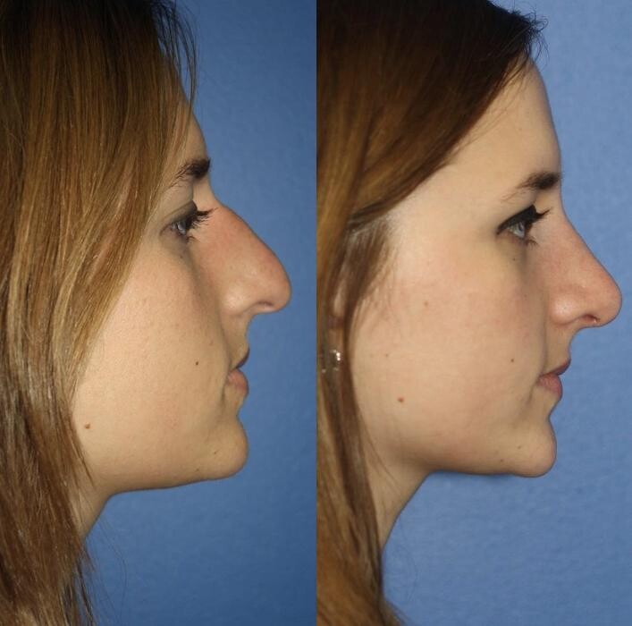 Images Gotham Plastic Surgery