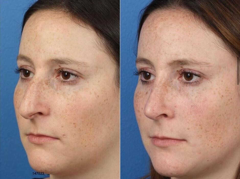 Images Gotham Plastic Surgery