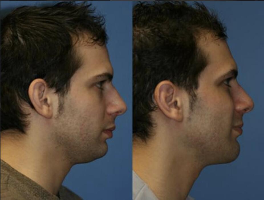 Images Gotham Plastic Surgery