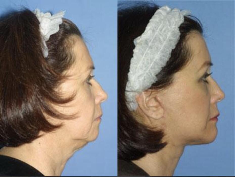 Images Gotham Plastic Surgery