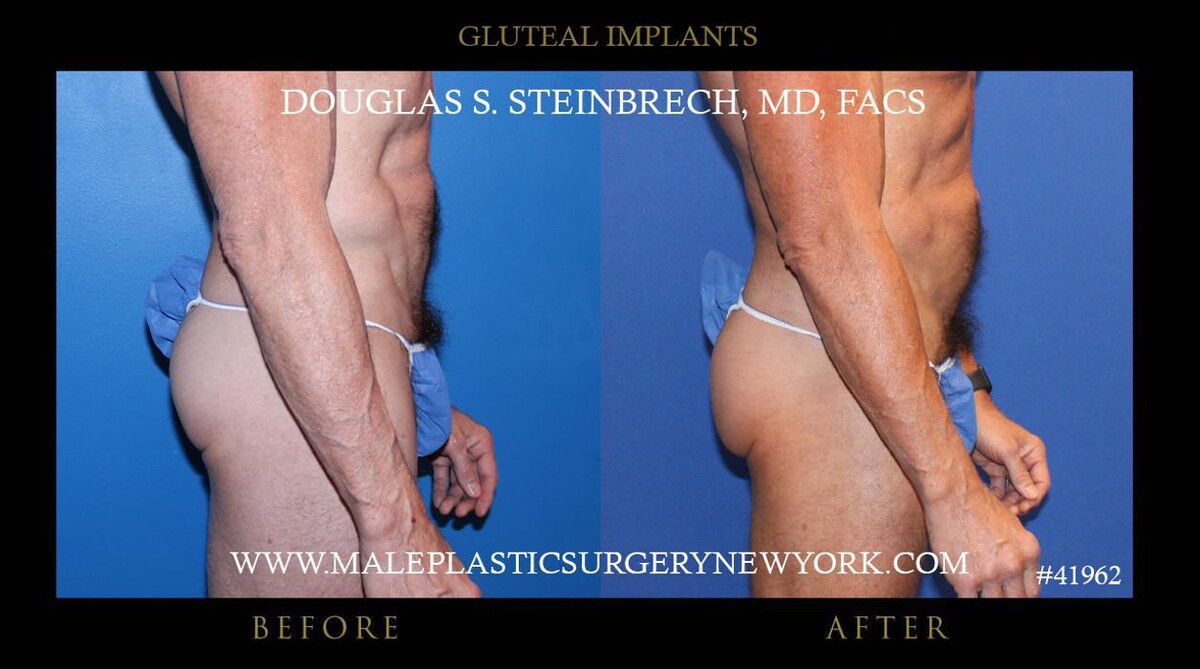 Images Gotham Plastic Surgery