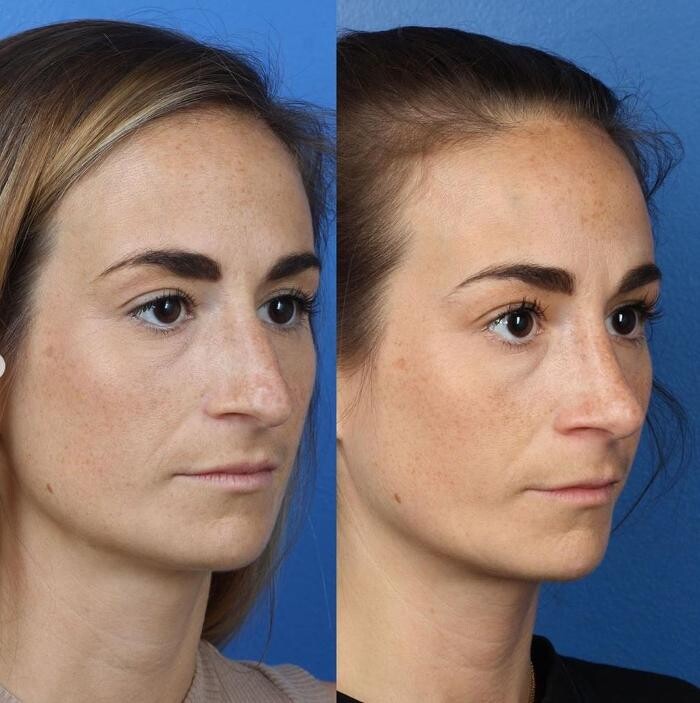 Images Gotham Plastic Surgery