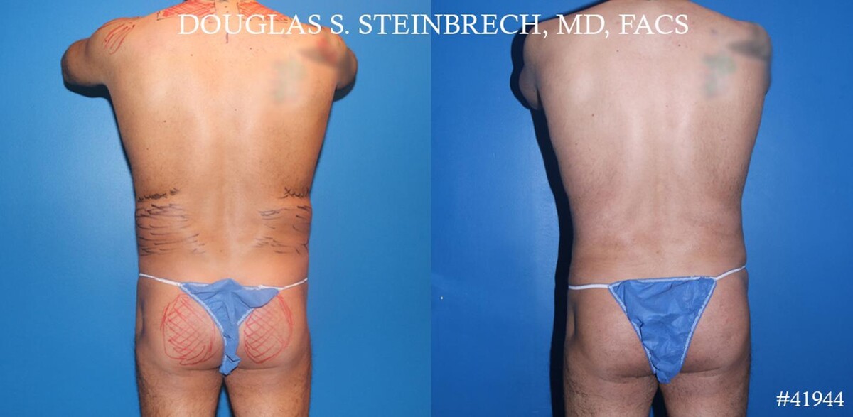 Images Gotham Plastic Surgery