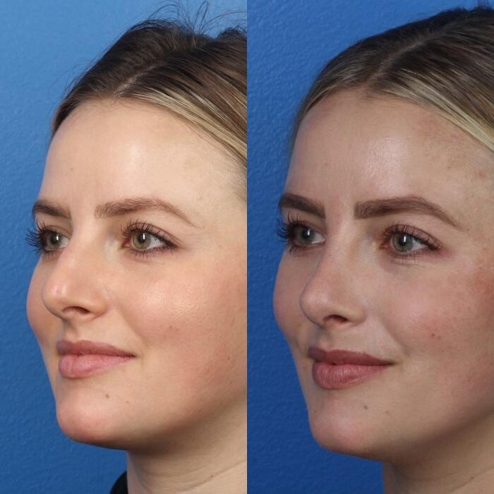 Images Gotham Plastic Surgery