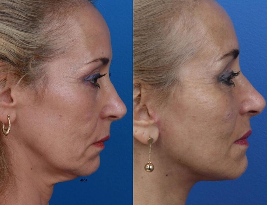 Images Gotham Plastic Surgery