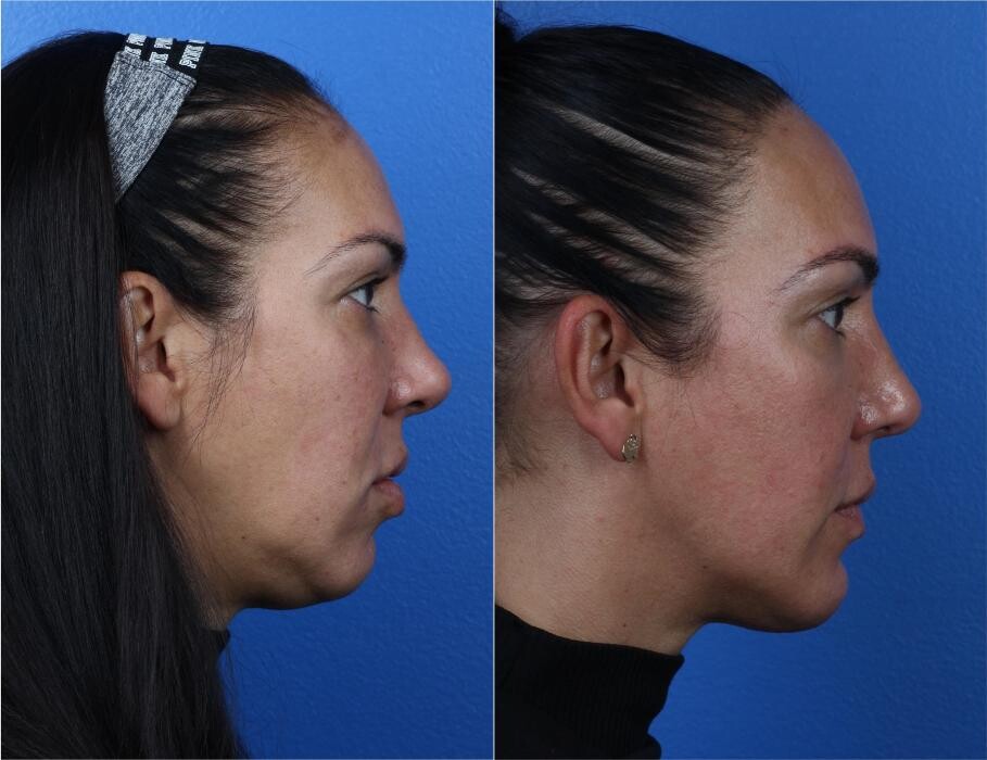 Images Gotham Plastic Surgery