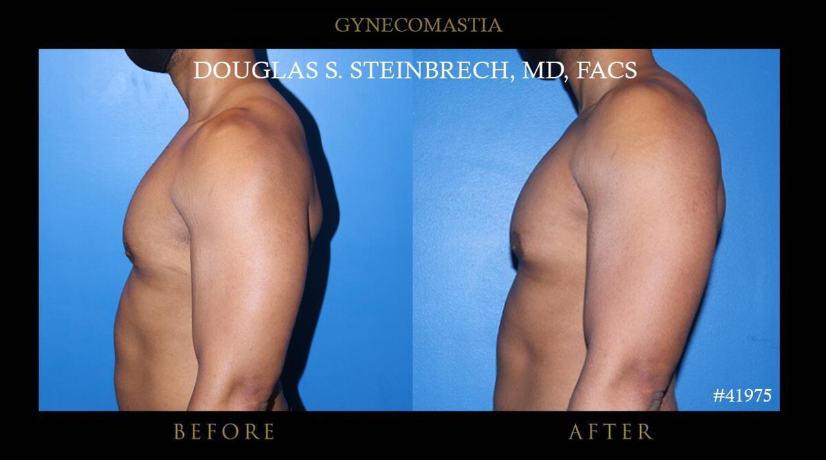 Images Gotham Plastic Surgery