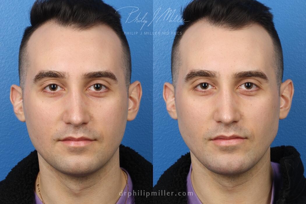 Images Gotham Plastic Surgery