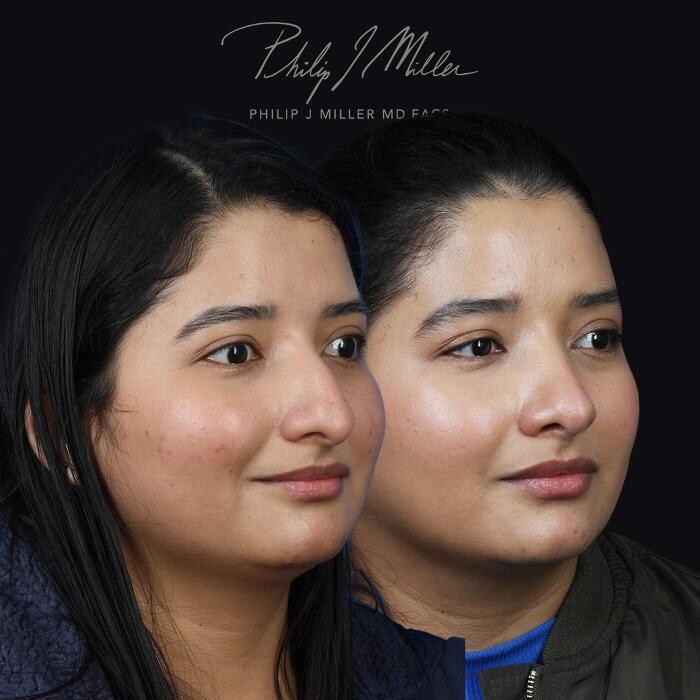 Images Gotham Plastic Surgery