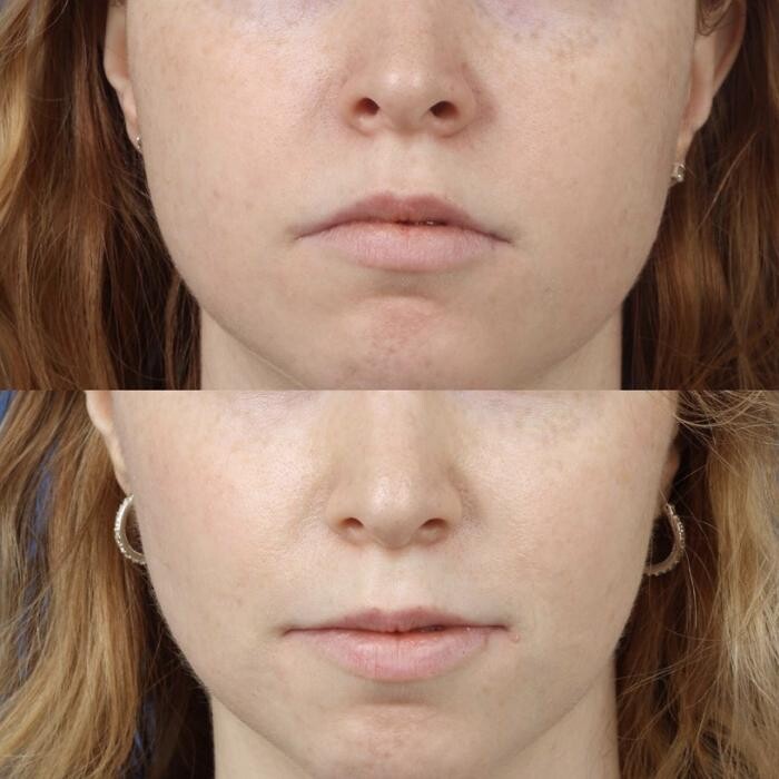 Images Gotham Plastic Surgery